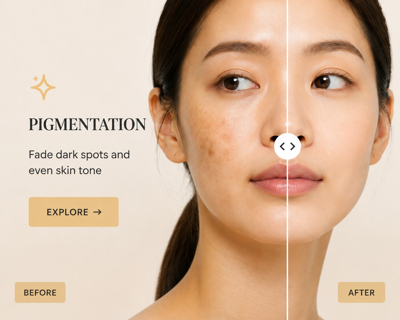 Pigmentation